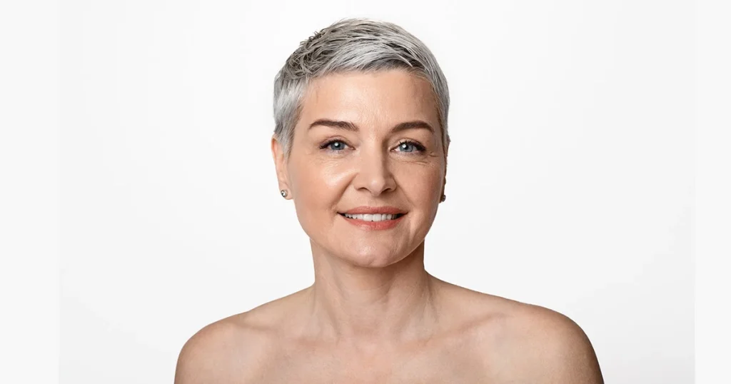 blefaroplastia-superior