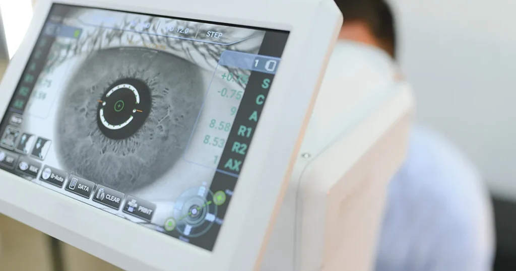 como-mejorar-vision-despues-cirugia-catarata
