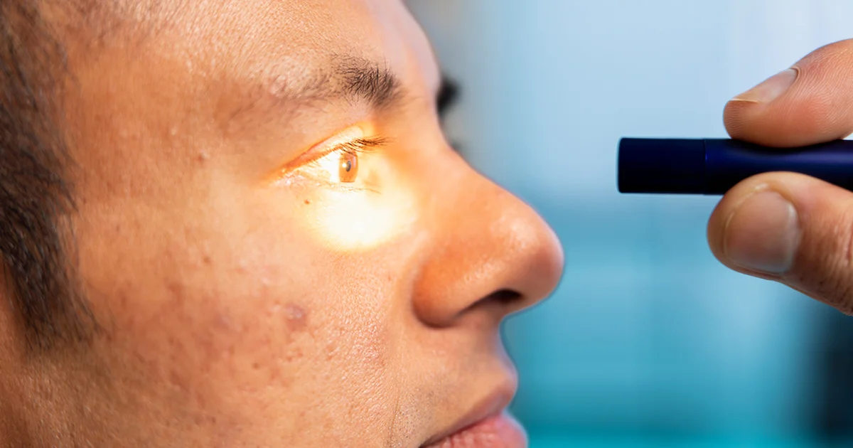 errores-comunes-higiene-ocular